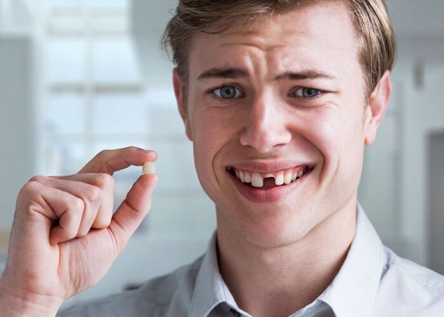 Mơ rụng răng liệu có phải là điềm lành?